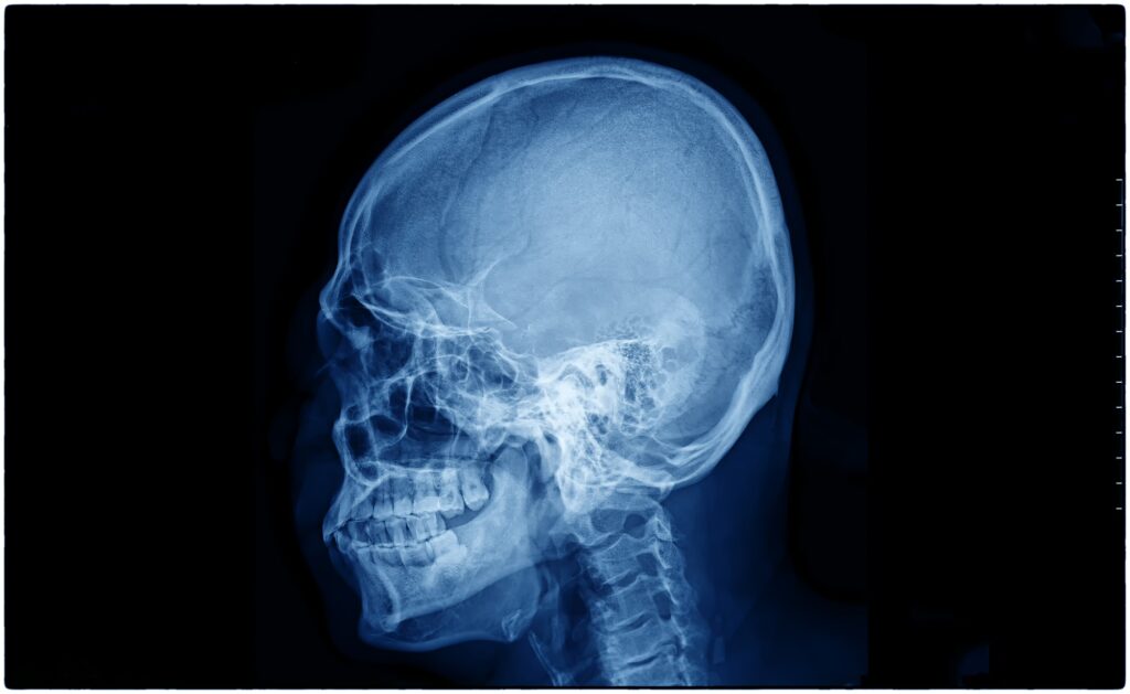 X-Ray film scan of human.